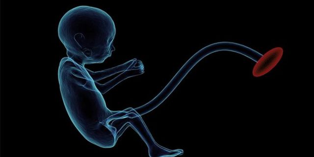 Çin'de 1 yaşındaki bebeğin beyninden doğmamış ikizi çıkarıldı