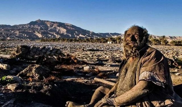 70 yıldır yıkanmadı duş alınca hayatını kaybetti