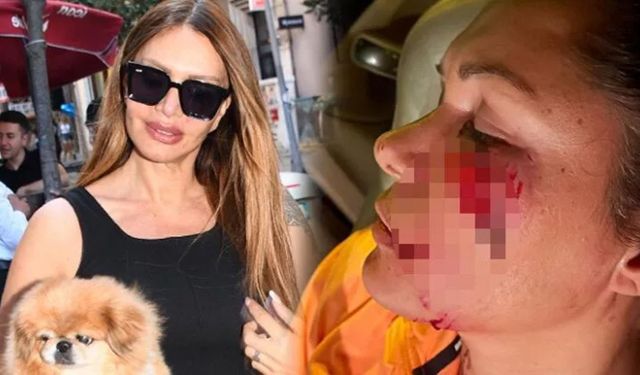 Sevda Demirel'den şaşırtan açıklama! Tuğba Altıntop'a köpek saldırmamıştır