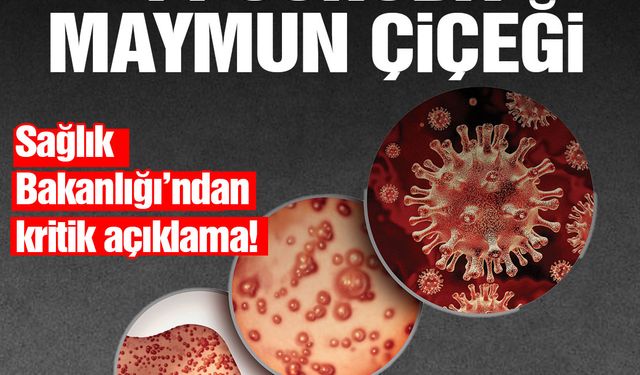 Sağlık Bakanlığı merak edilenleri yanıtladı: 11 soruda maymun çiçeği virüsü