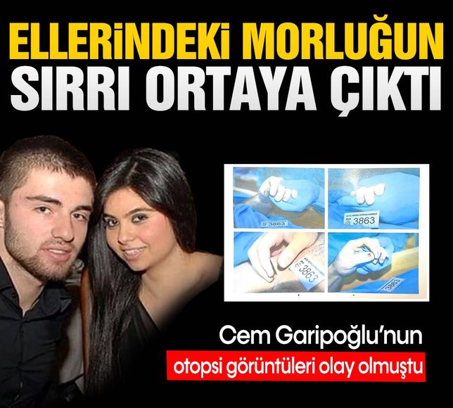 Cem Garipoğlu’nun otopsi görüntüleri olay olmuştu! Ellerindeki ‘morarmanın’ sırrı ortaya çıktı