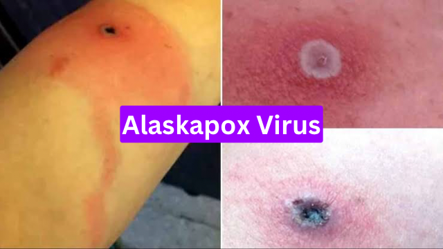 Alaskapox