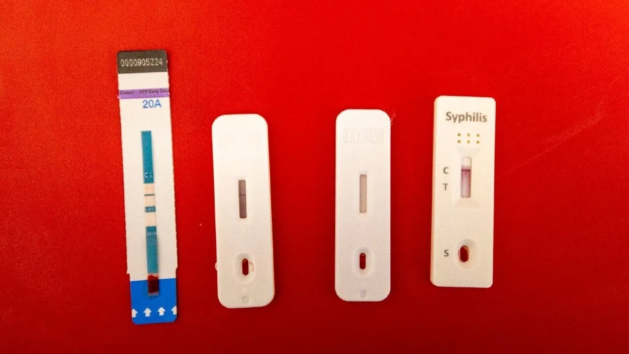 İzmir’de Ücretsiz Ve Kimliksiz Hiv Testi Başladı Sonuç 20 Dakikada Çıkıyor (1)