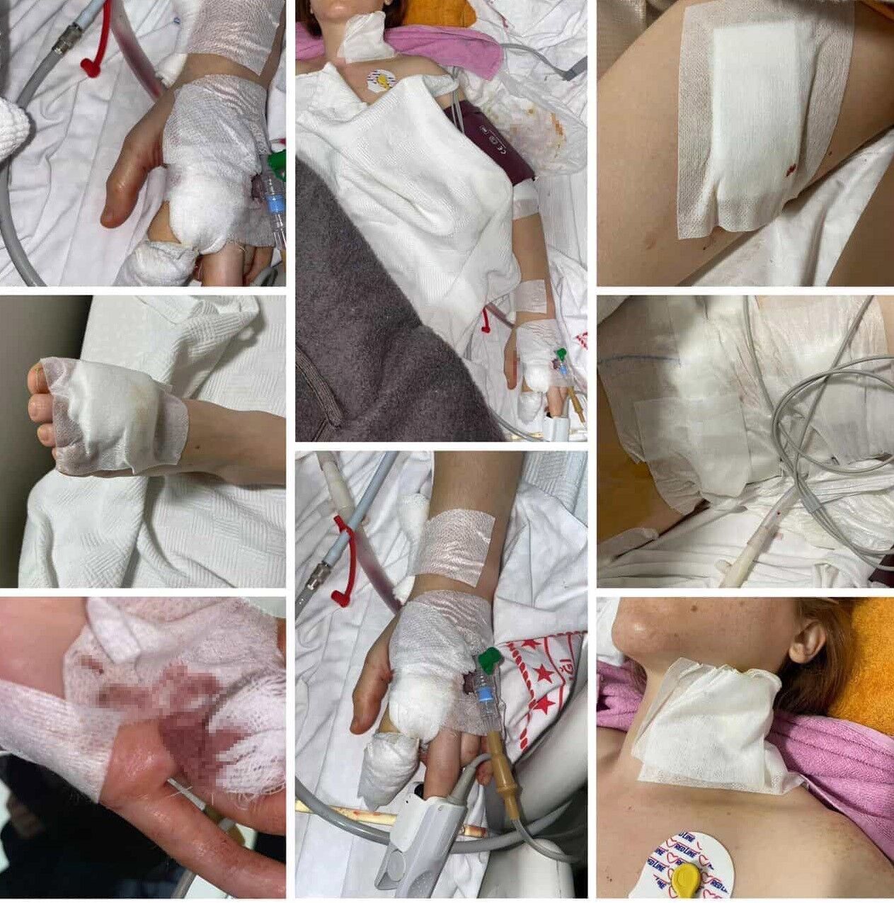 Yine Uzaklastirma Yetmedi Izmirde Kadin 11 Yerinden Bicaklandi